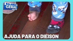 mae-precisa-de-r$25-mil-para-custear-cirurgia-em-um-dos-pes-do-filho