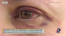 mulher-vitima-de-agressoes-e-carcere-privado-pede-ajuda-em-posto-de-saude-de-cordilheira-alta